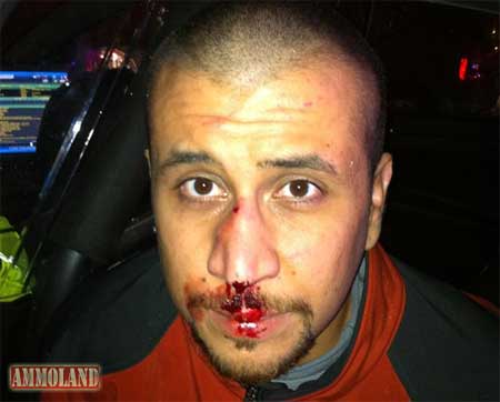 George Zimmerman