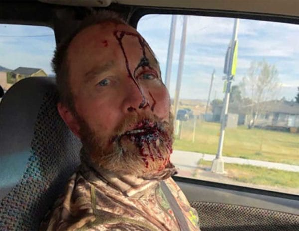 New Mexico Hunter Mauled in Bear Attack Montana 16 Sept photo released by hunter 600